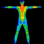 Thermography at WIN Health Institute